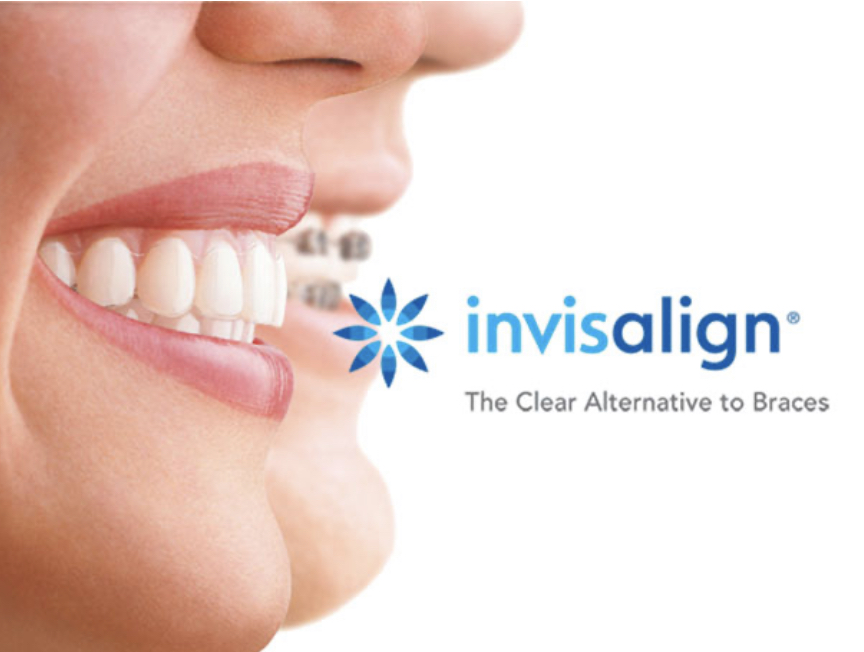 Invisalign